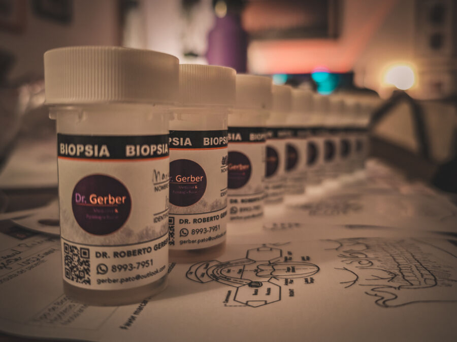 Recipientes para biopsias bucales utilizados en el servicio de diagnóstico histopatológico del Dr. Roberto Gerber, especialista en Patología y Medicina Bucal en Costa Rica.